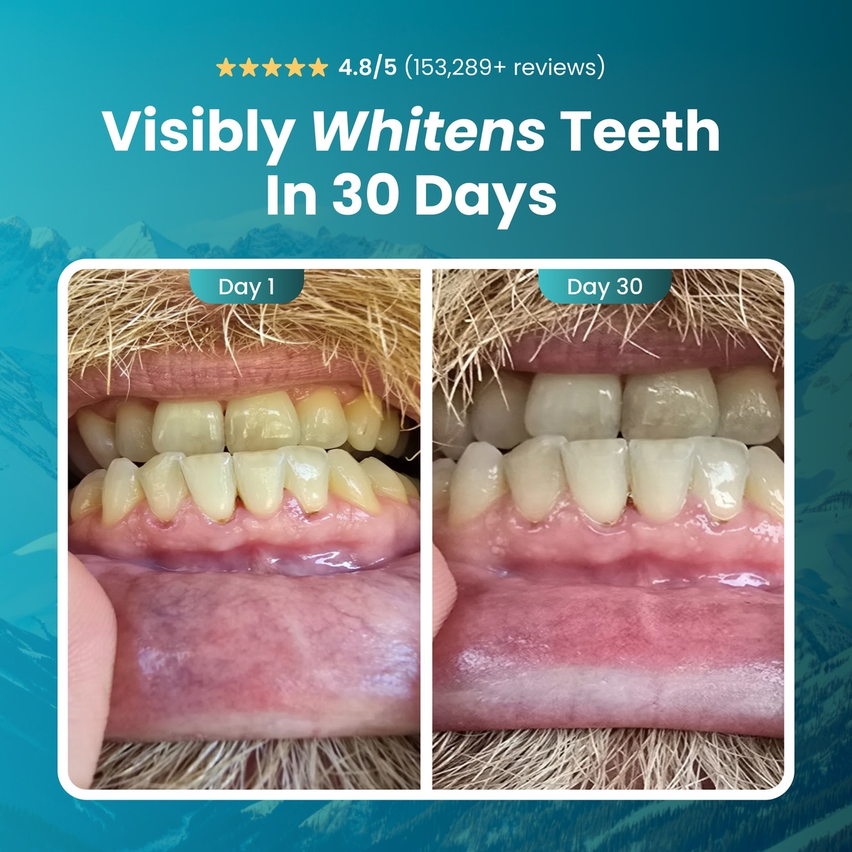 Mastic Mint Remineralizing Gum